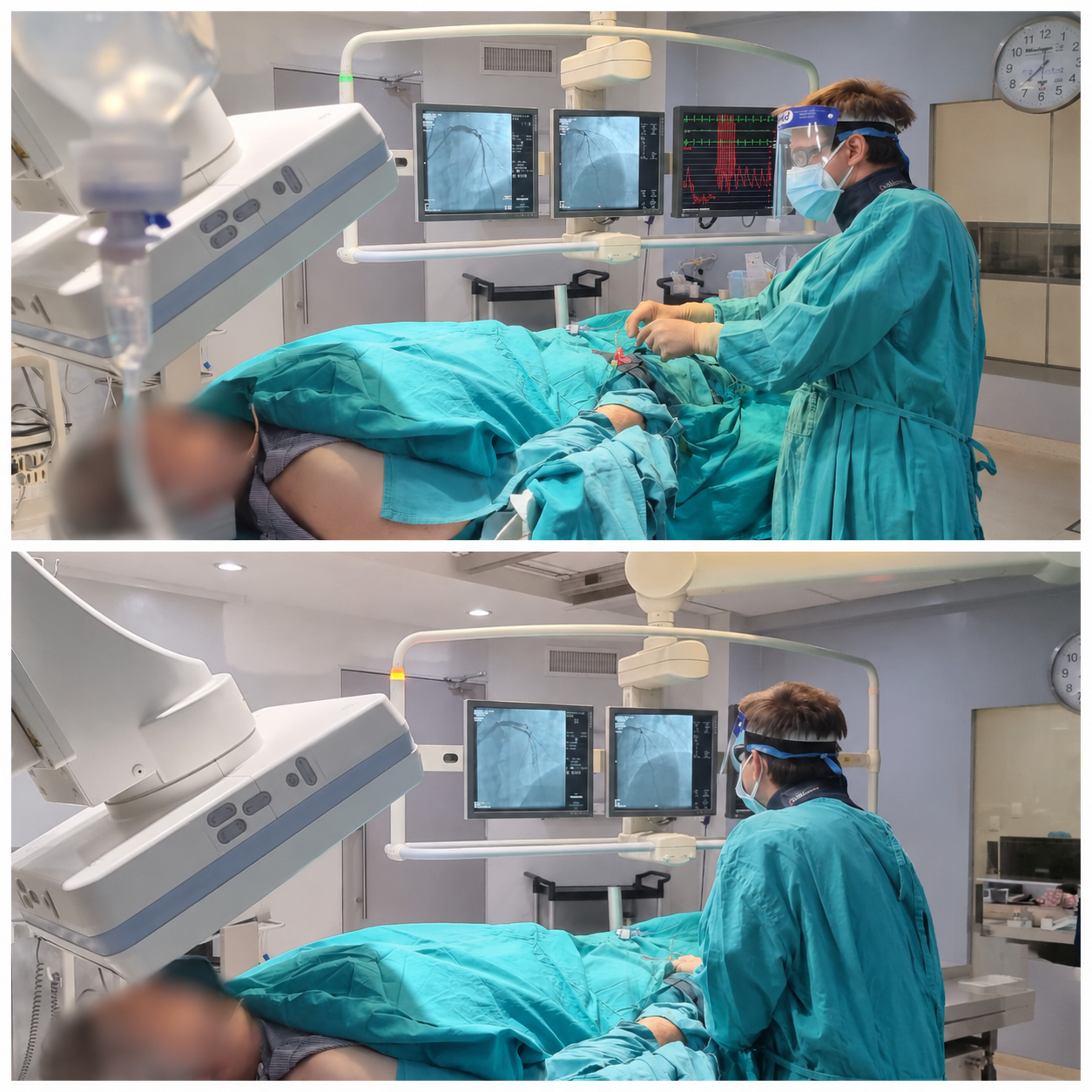 Angioplastía coronaria con stent - Procedimiento de cardiología intervencionista por el Dr. Walter John Herrera Rucaj